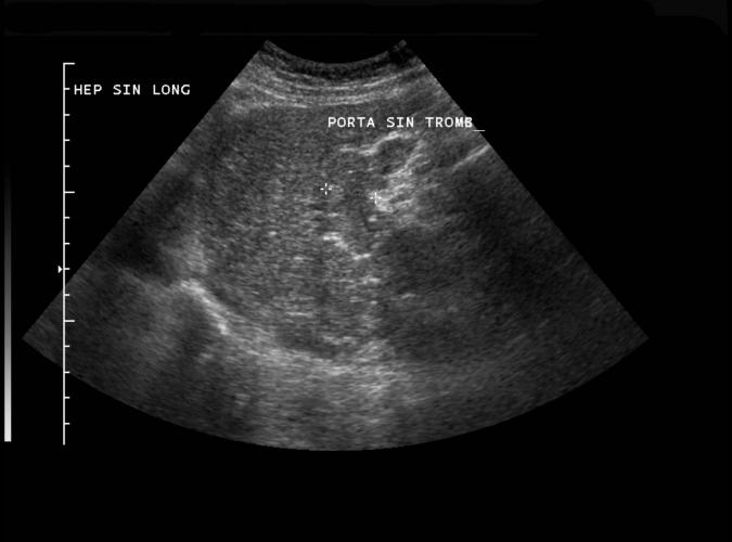 2g av Catherine Olsson, sonograf